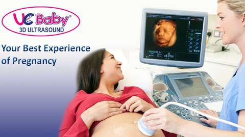 UC Baby 3D Ultrasound